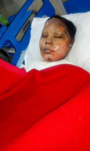 Spurned Muslim man throws acid over Christian girl then set her alight – now Asma Yaqoob is fighting for her life!