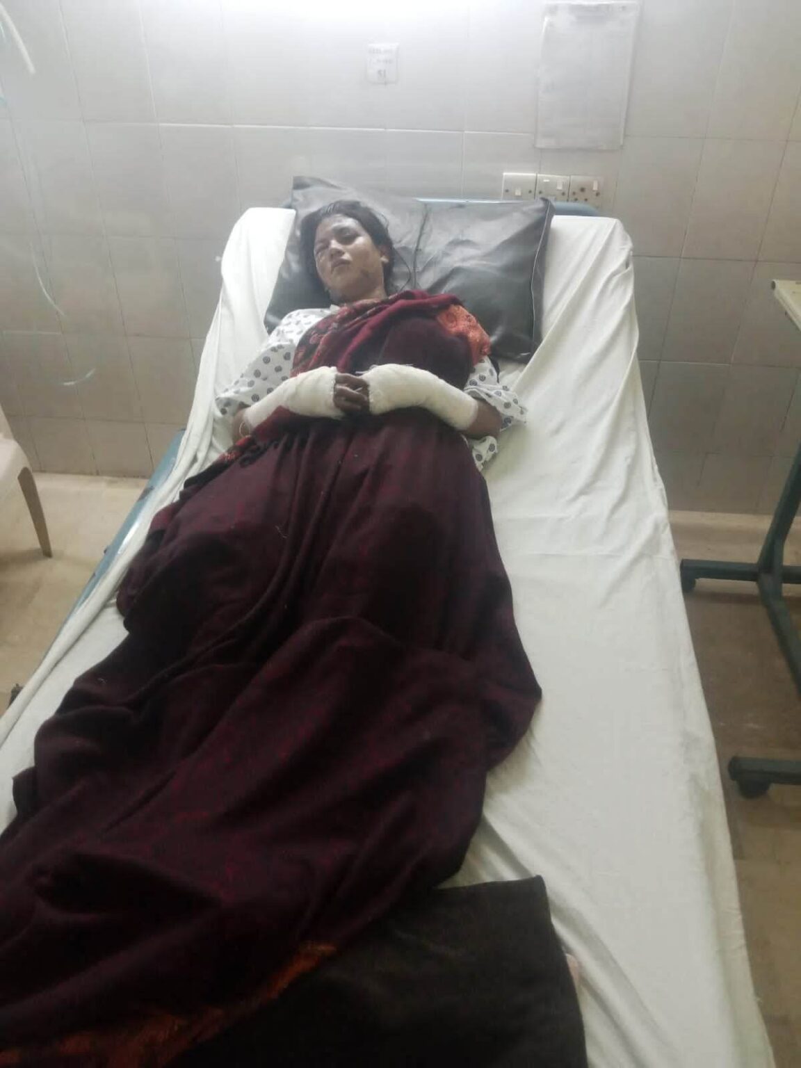 Christian woman has acid thrown over face after refusing romantic